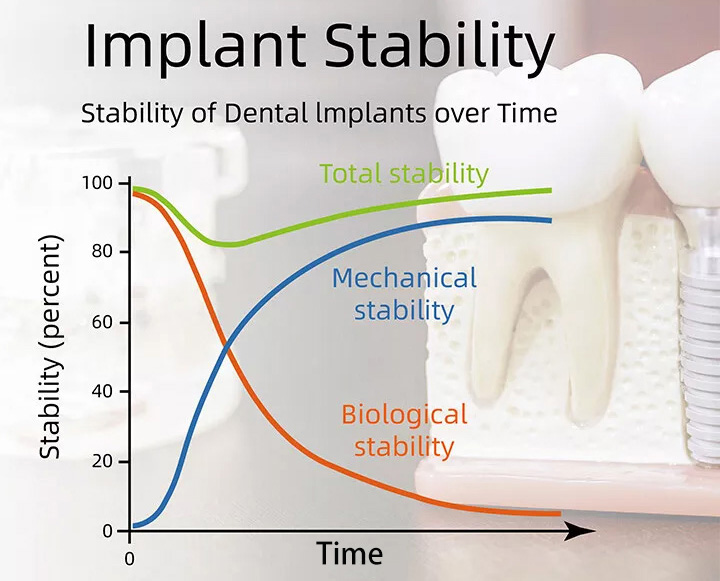 YAHOPE iCHECK Handheld Dental Implant Stability Meter Implant Stability Measurement ISQ Monitor 